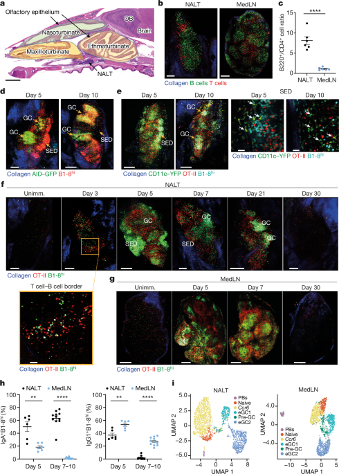 The cells that make up turbinate-homing IgA-secreting are located in the nasal lymphoid tissues